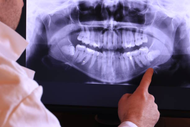 Best Emergency Gum Treatment in Everett, PA